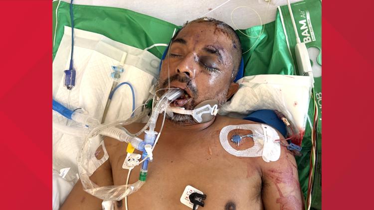 University Hospital asks for help identifying unconscious patient hit by truck Saturday evening — KENS 5 (San Antonio), Brooklyn Park Health news